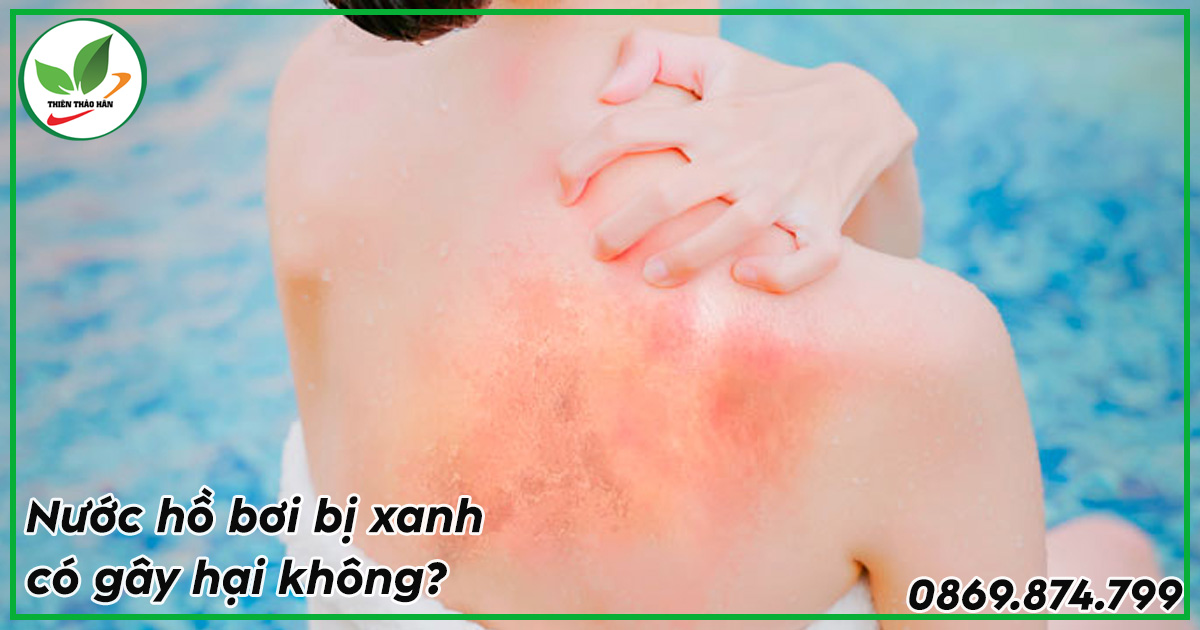 Nước hồ bơi bị xanh có hại gì?